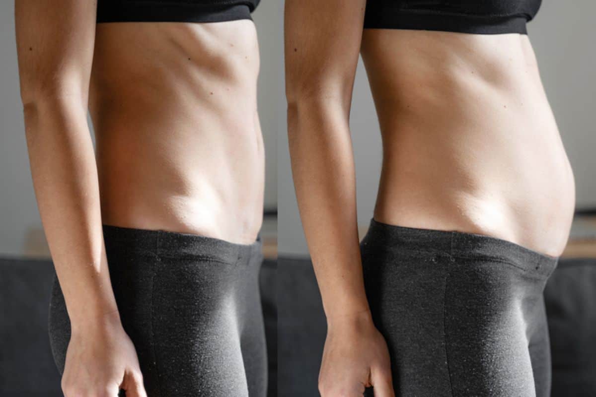 How long does diastasis recti take to improve Chippenham?