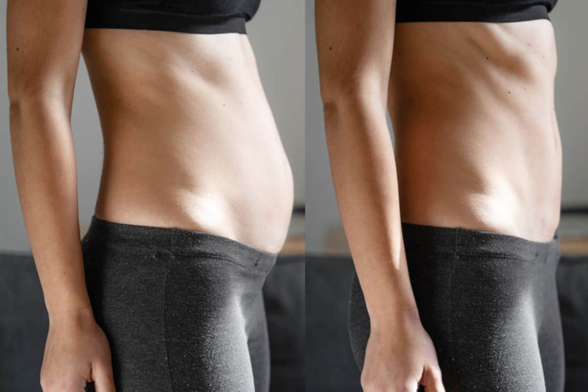 Post-Pregnancy: What Happens to Your Abdominal Muscles After Birth Chippenham
