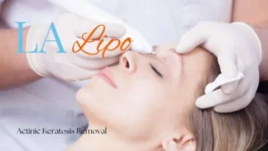 Woman receiving Actinic Keratosis Removal Treatment Chippenham