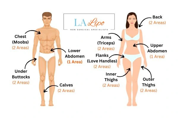 LA LIPO Cryolipolysis Areas Chippenham