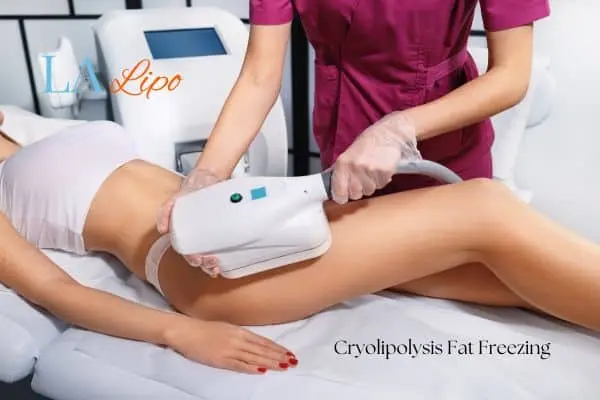 Woman receiving coolsculpting Chippenham treatment on her thighs