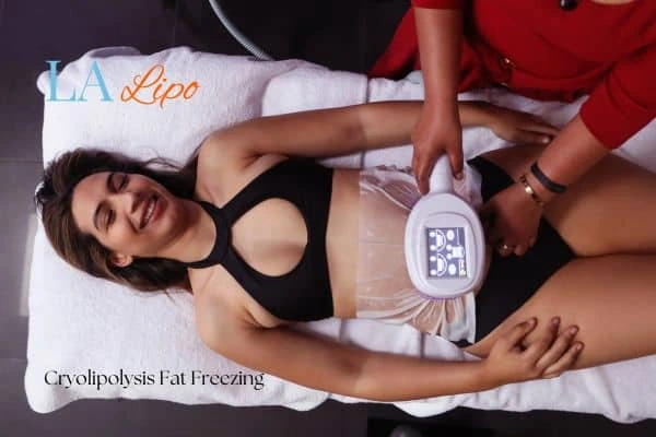woman getting cryolipolysis Chippenham