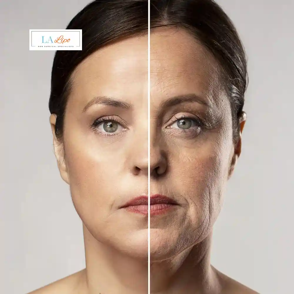 How Can You Tell If Non-Surgical Skin Tightening Is Right for You Chippenham?