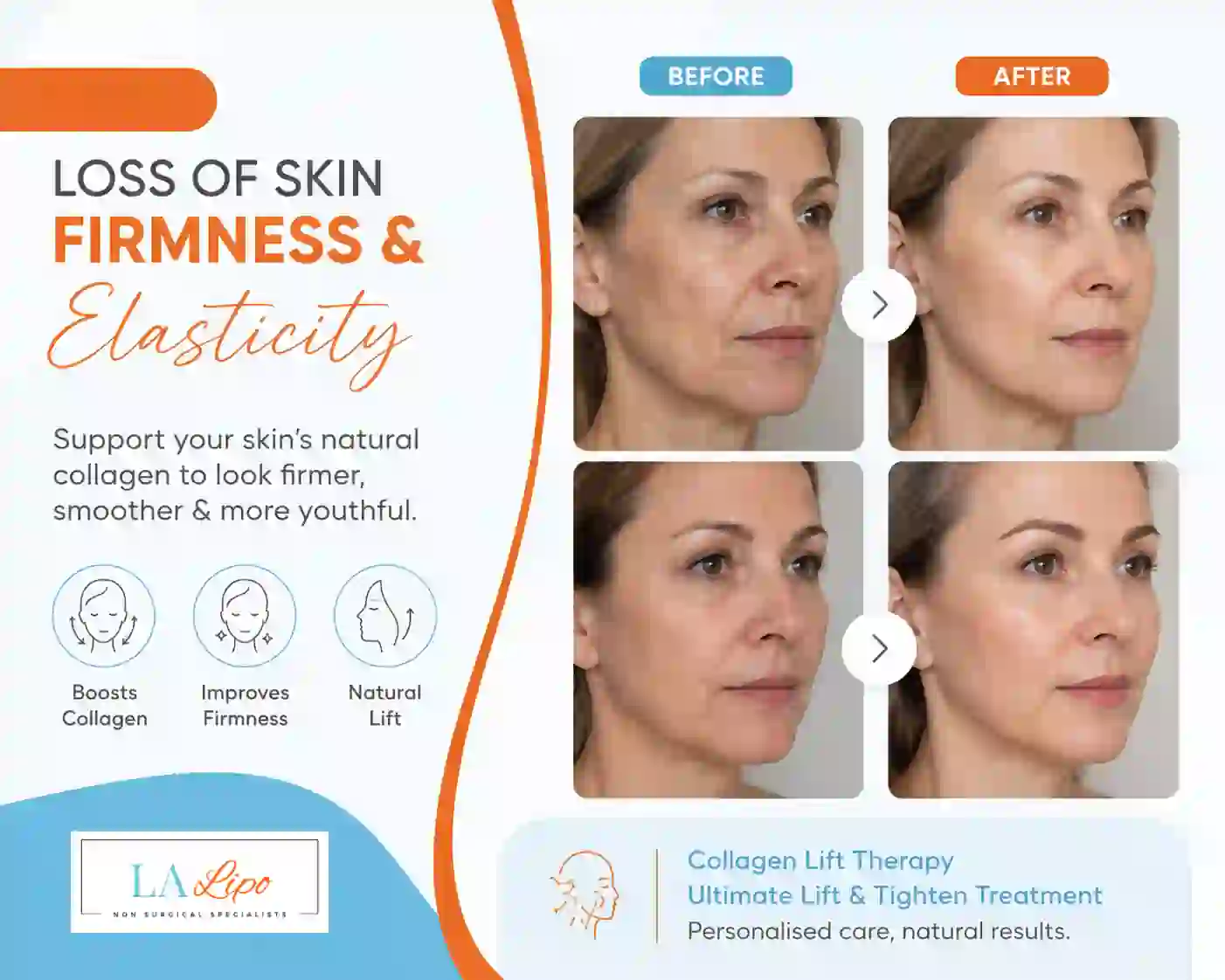 Sign #7: Loss of Skin Firmness and Elasticity Chippenham