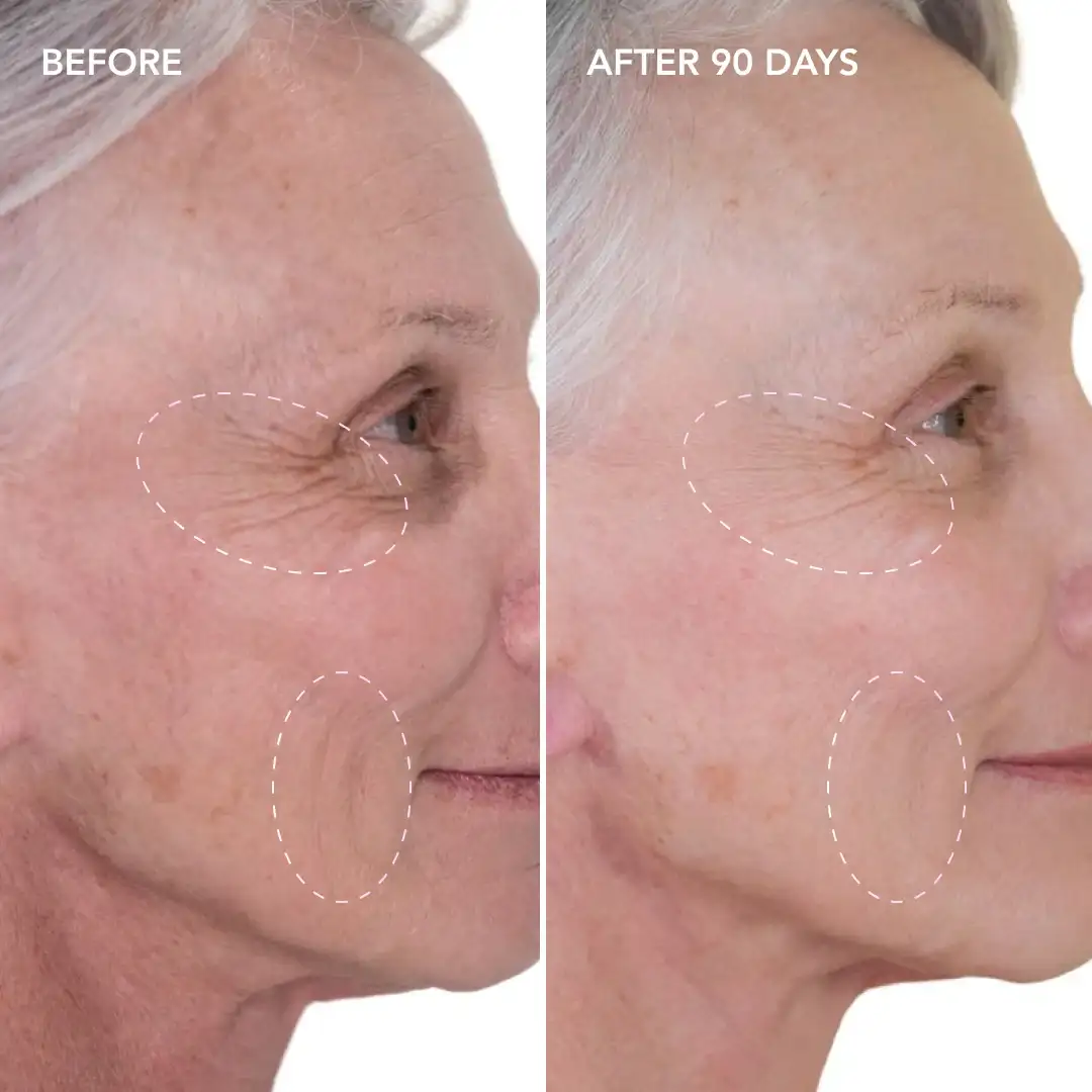 When will you see results Chippenham